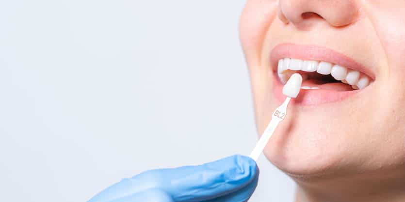 A dentist holding up a white shade to compare the patient's teeth after she received tooth whitening treatment.