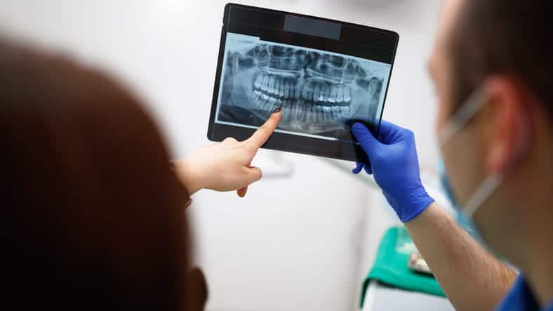 Two dentists looking and pointing at a dental X-ray that shows a tooth that needs to be removed.